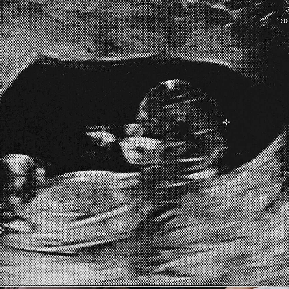 Die Gebärmutter - ein faszinierendes Organ